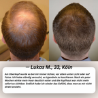 PURCVELTOR Haarserum für Männer 2.0