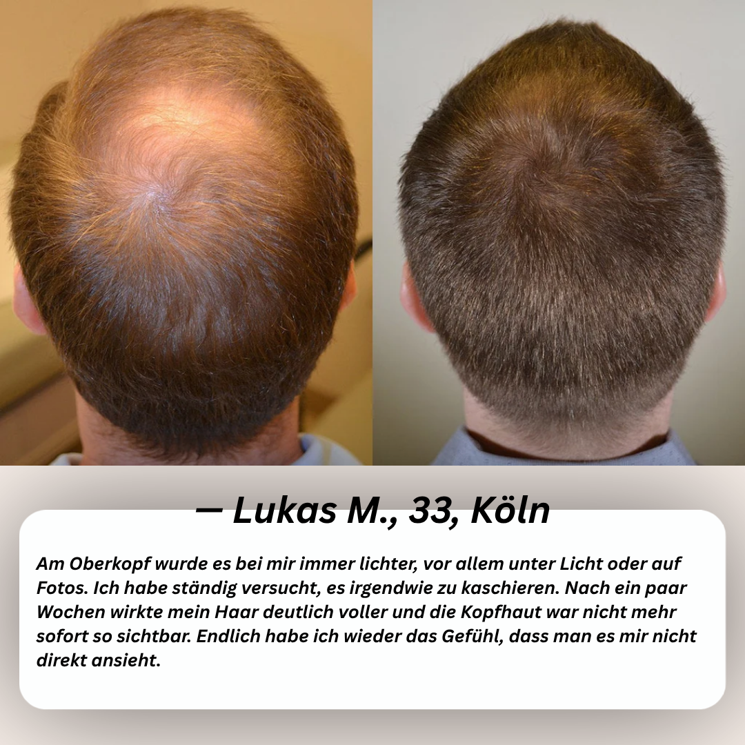 PURCVELTOR Haarserum für Männer 2.0