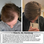 PURCVELTOR Haarserum für Männer 2.0