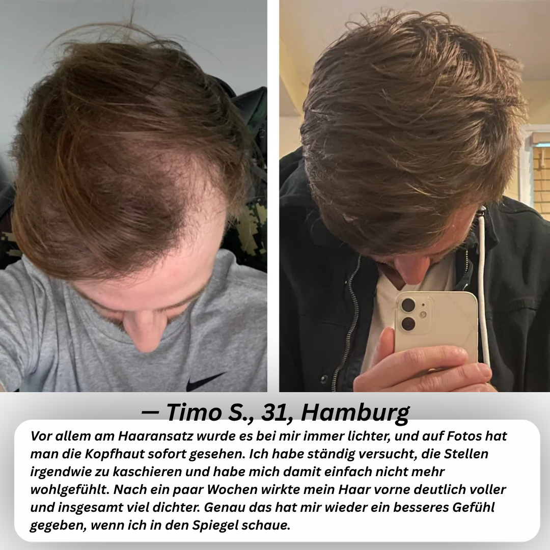 PURCVELTOR Haarserum für Männer 2.0