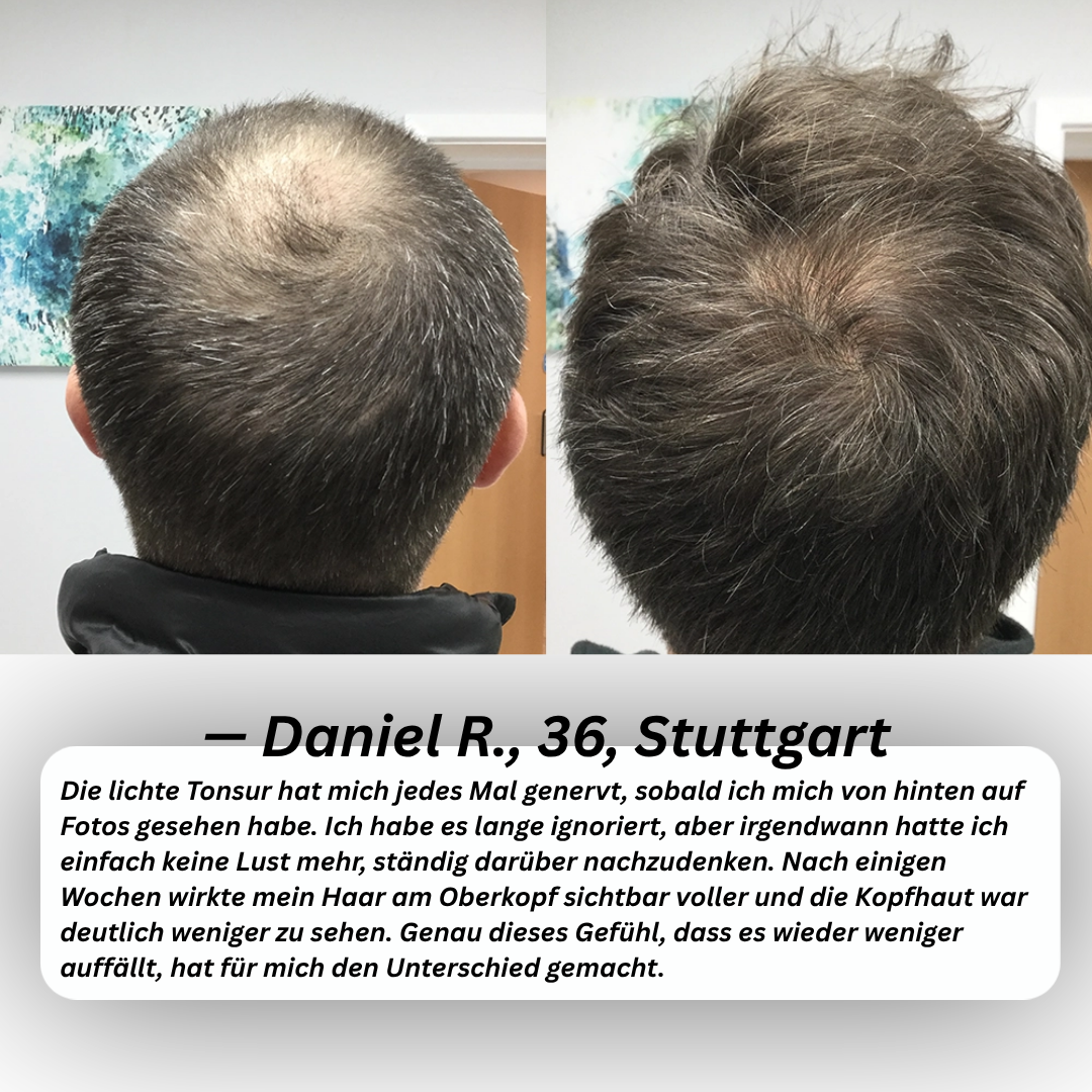 PURCVELTOR Haarserum für Männer 2.0